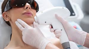 laser hair removal